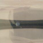 Мезороллер (дермороллер)